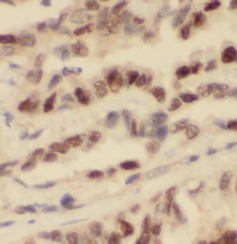 PYCARD Rabbit Polyclonal Antibody