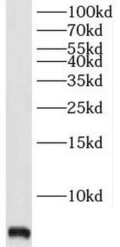 TMSB4X Antibody