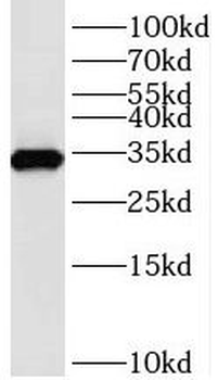 TMX2 Antibody