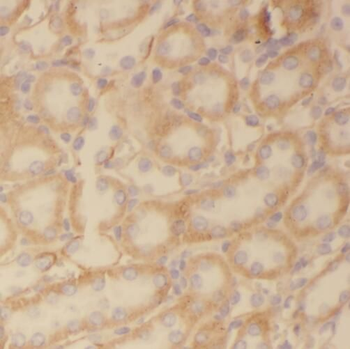 TMX2 Antibody