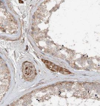 TMX3 Antibody
