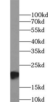 TNF alpha Mouse Monoclonal Antibody