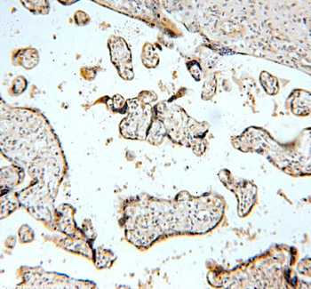 TNFAIP1 Antibody