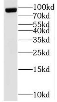 TNFAIP3 Rabbit Polyclonal Antibody