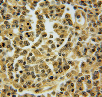 TNFAIP8L2 Antibody