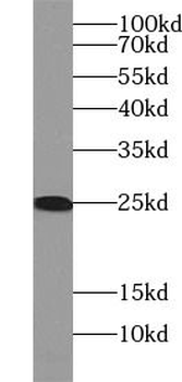 TNF alpha Rabbit Polyclonal Antibody