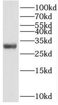 TNFRSF13B Antibody