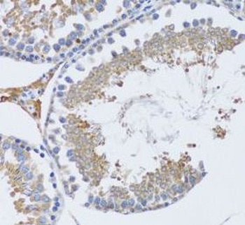 TNFSF12 Antibody