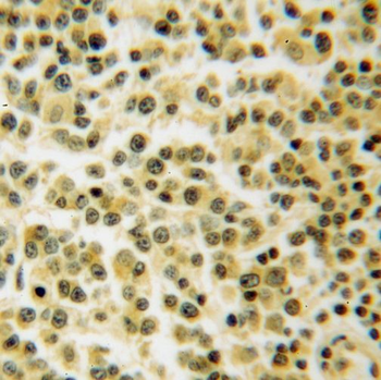 TNIP1 Antibody