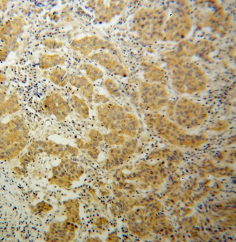 TNK1 Antibody