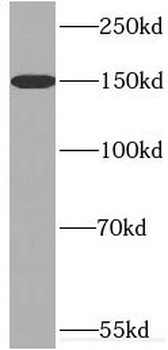 TNKS Antibody