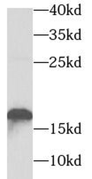 TNNC2 Antibody