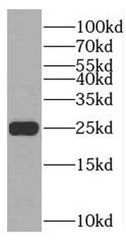 TNNI1 Antibody