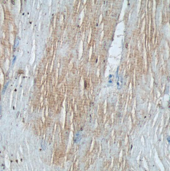 TNNI1 Antibody