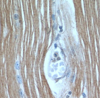 TNNI1 Antibody