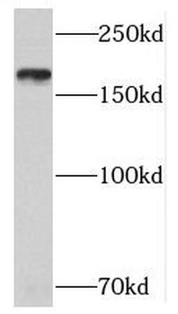 TNS1 Rabbit Polyclonal Antibody