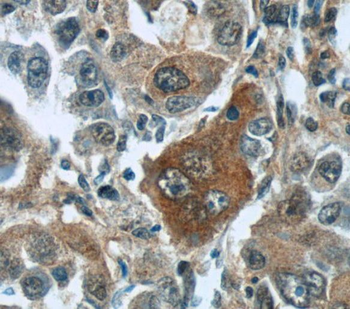 TNS4 Antibody