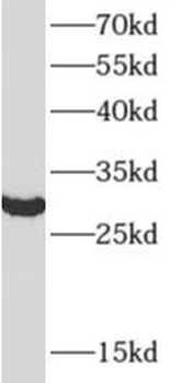 TOLLIP Antibody