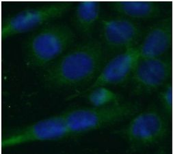 TOLLIP Antibody