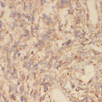TOLLIP Antibody