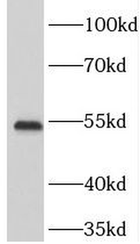 TOM1 Rabbit Polyclonal Antibody