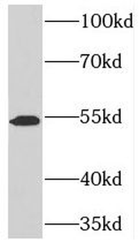 TOM1 Rabbit Polyclonal Antibody