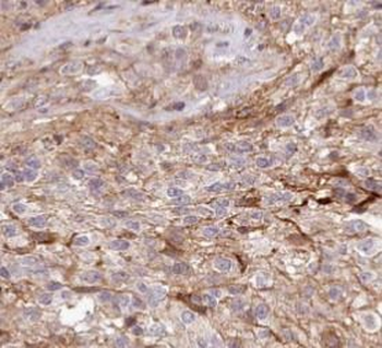 TOMM20 Antibody