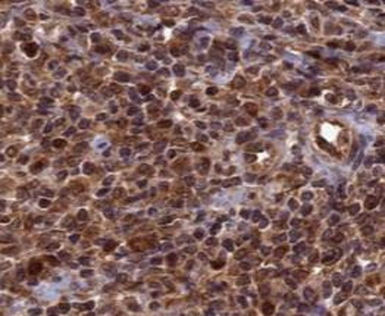 TOP1 Antibody