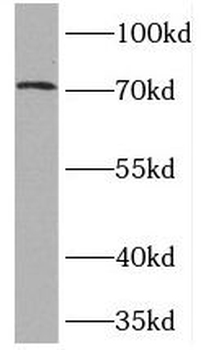 TOP1MT Antibody