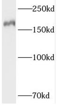 TOP2B Antibody