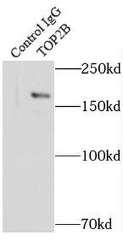 TOP2B Antibody