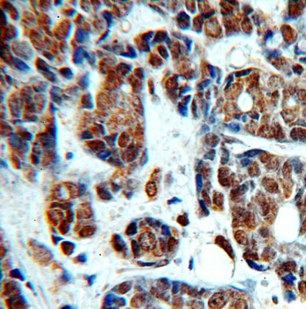 TOP2B Antibody