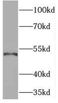 TOR1AIP1 Antibody