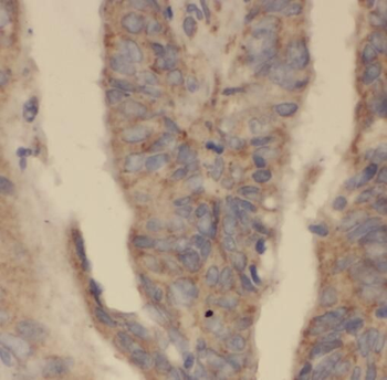 TOR1A Antibody