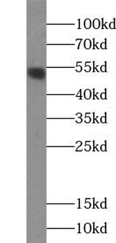 TP53 Rabbit Polyclonal Antibody