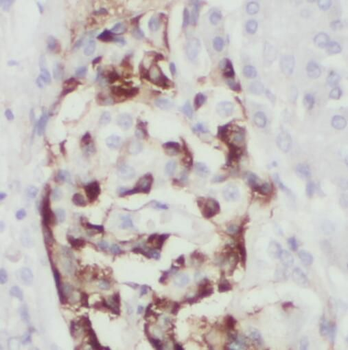 PLAT Antibody