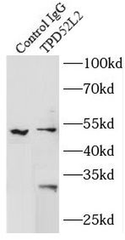TPD52L2 Antibody