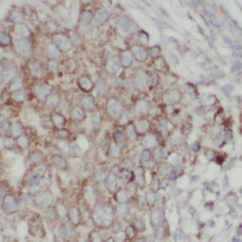 TPD52L2 Antibody