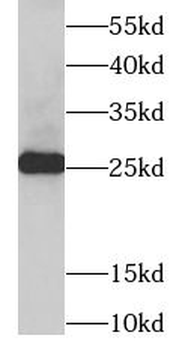 TPI1 Antibody