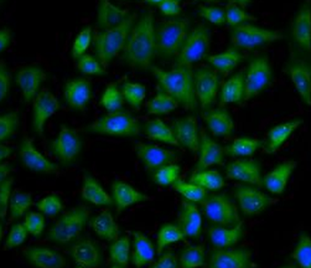 TPI1 Antibody