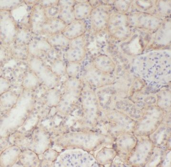 TPI1 Antibody