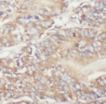 TPK1 Antibody
