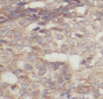 TPM2 Antibody