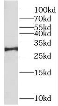 TPMT Antibody
