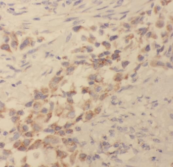 TPMT Antibody