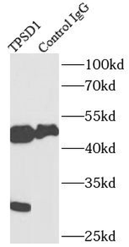 TPSD1 Antibody