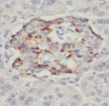 TPST2 Antibody
