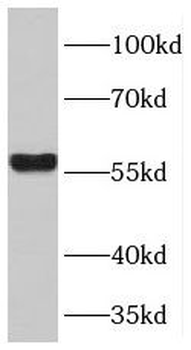TPTE2 Antibody