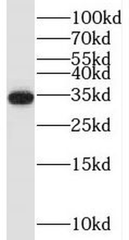 TRA2A Antibody