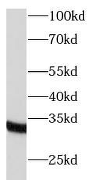 TRADD Antibody
